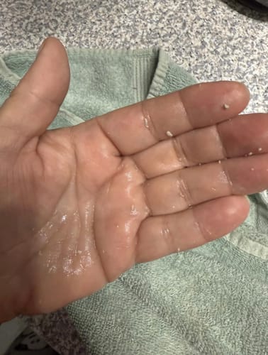 Customer photo review of Elimina puntos negros y piel muerta en minutos sin maltratar tu piel”