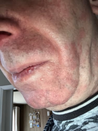 Customer photo review of Seb Natural Calming Serum