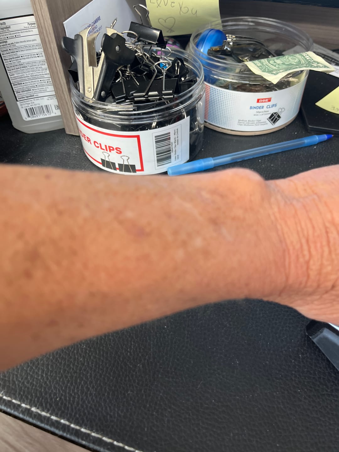 Customer photo review of Besque® Magic Body Oil - Unscented