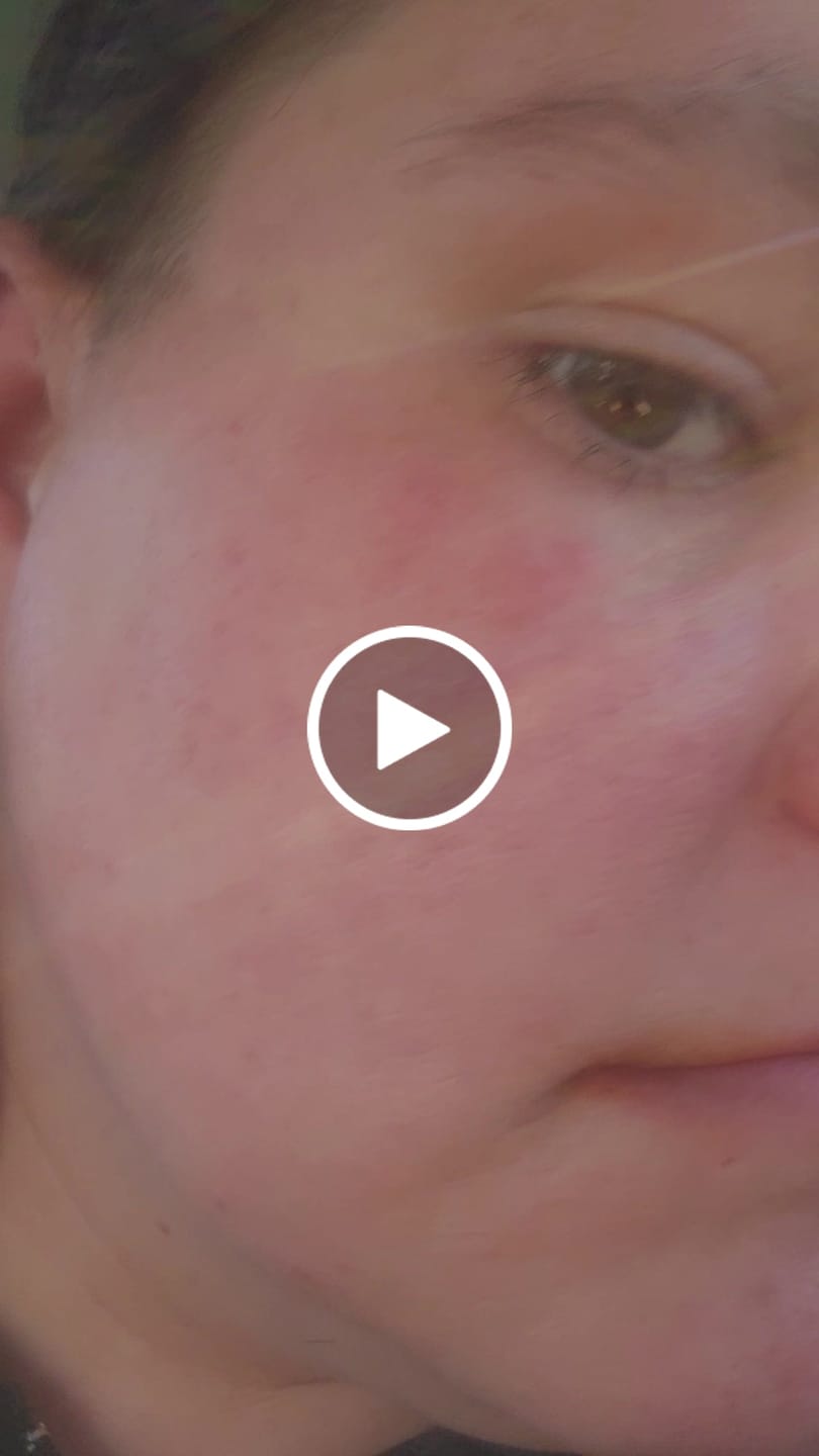Customer video review of Glass Skin Pads & Mask