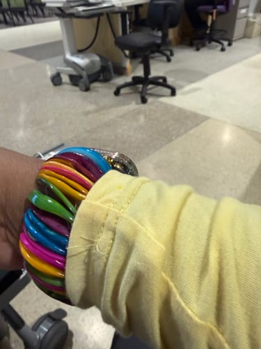 Customer showing the bright, vibrant Gold Dopamine Shell Stretch Apple Watch Strap on their wrist.