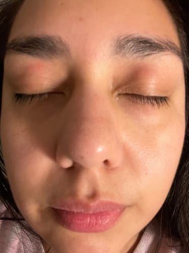 Customer photo review of Fera Tallow Colloidal Oat Whipped Tallow - Soothing Eczema & Sensitive Skin Cream