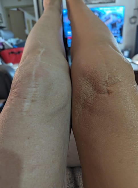 Customer photo review of Corrector Corporal