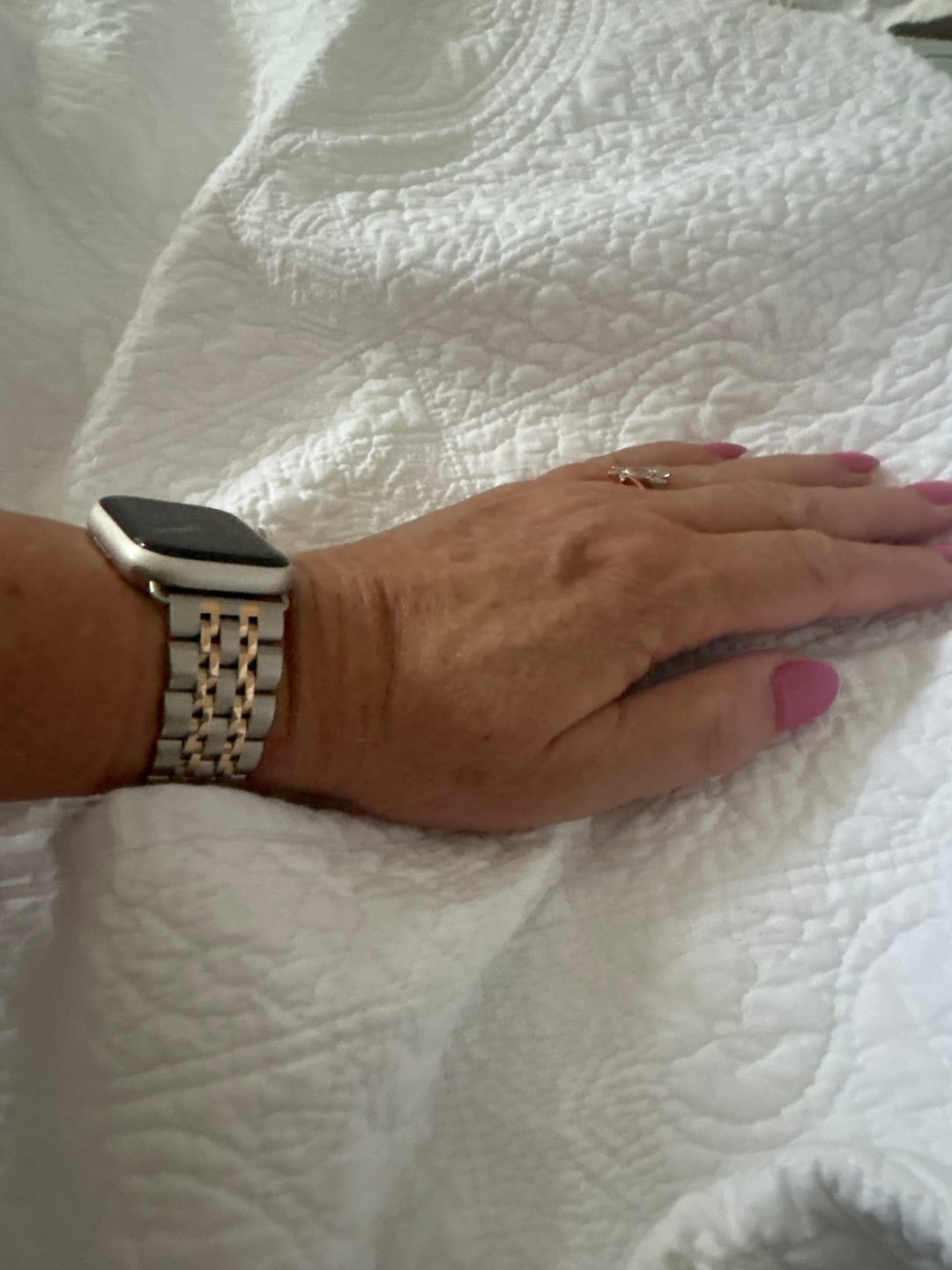 Customer photo review of Themis Stainless Band