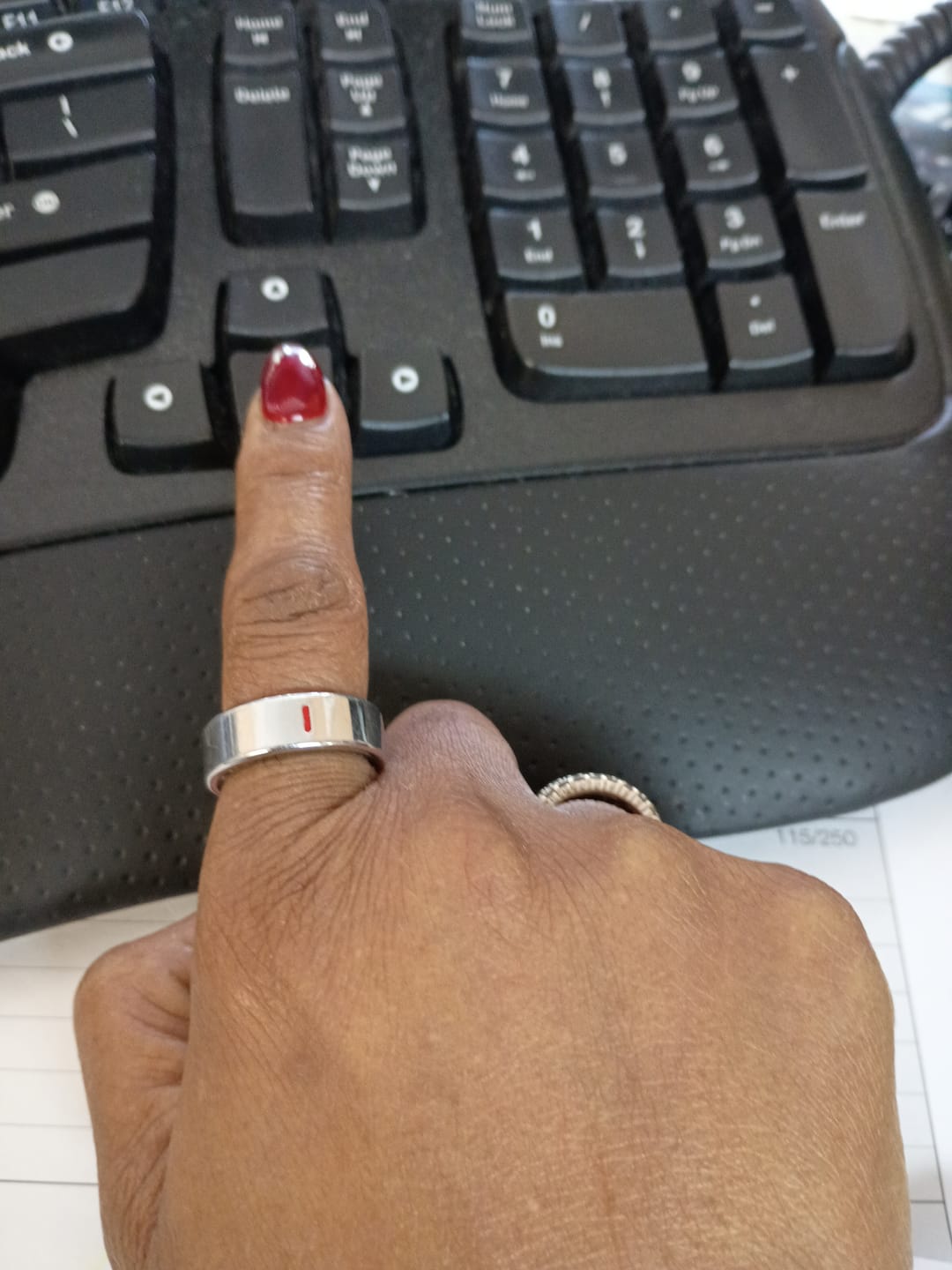 Customer photo review of Bearscome R03 Blood Sugar Blood Pressure Blood oxygen HRV Sleep Monitoring Waterproof Smart Ring
