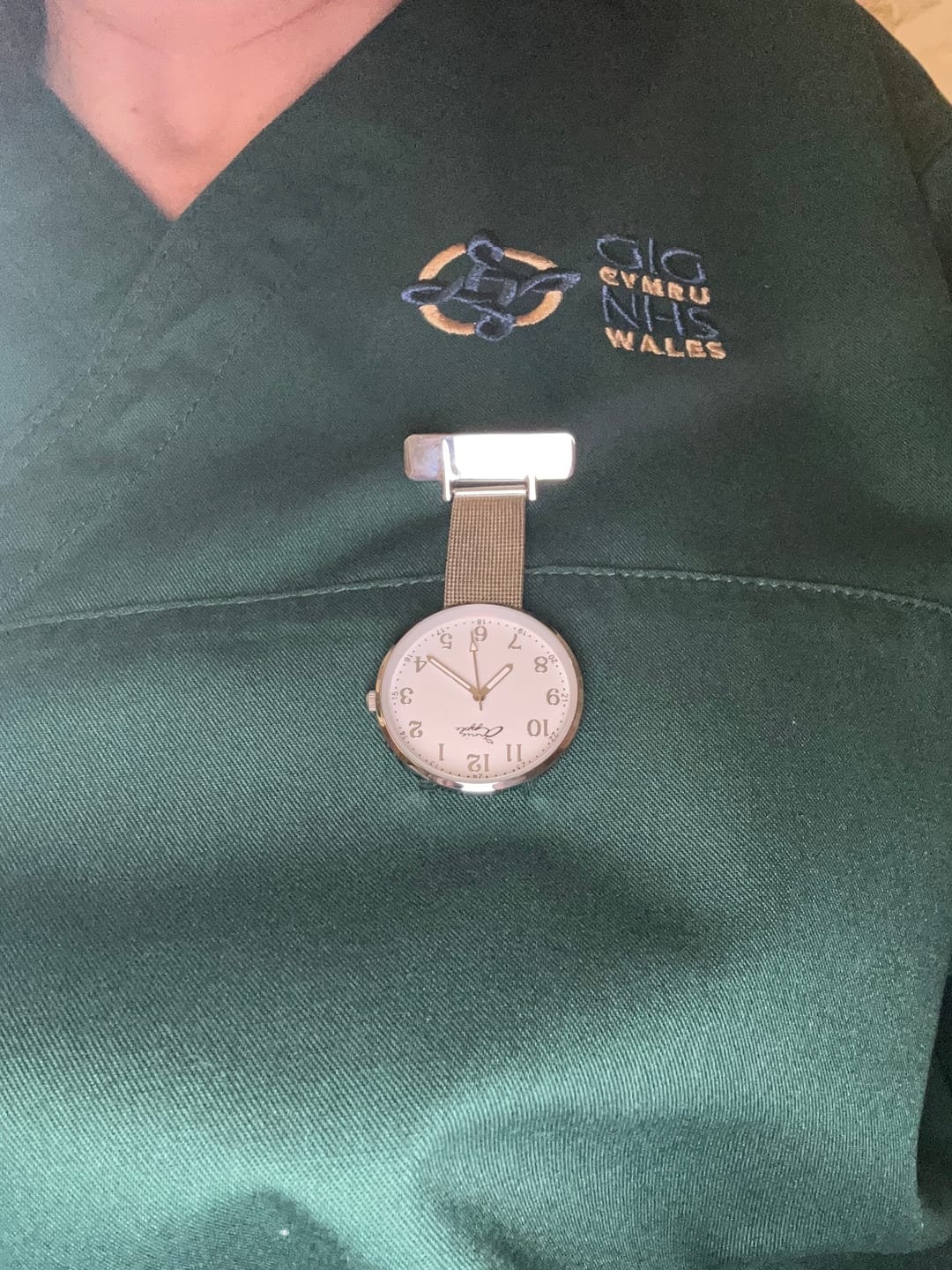 Customer photo review of Mystery Fob Watch