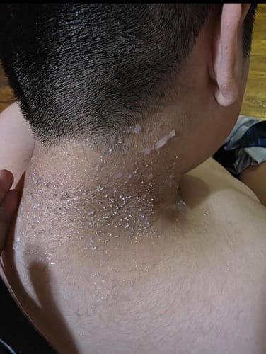 Customer photo review of Elimina puntos negros y piel muerta en minutos sin maltratar tu piel”