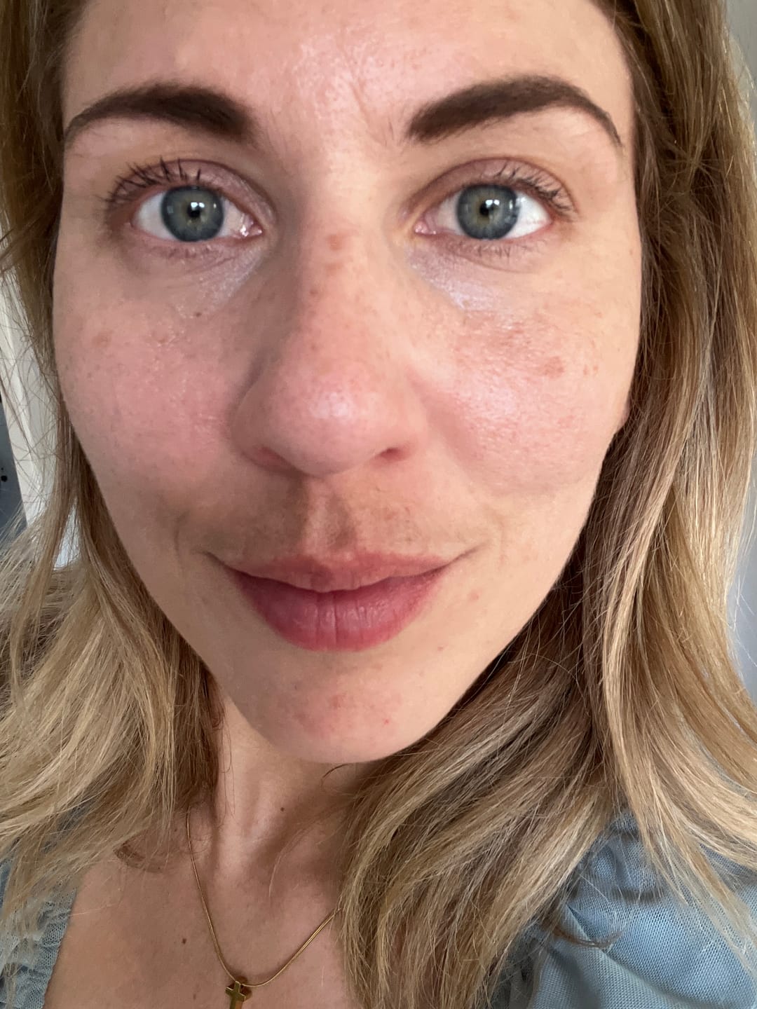 Customer photo review of Dark Circles Extreme - Under‑Eye Serum - Retinol & Hyaluronic Acid Treatment