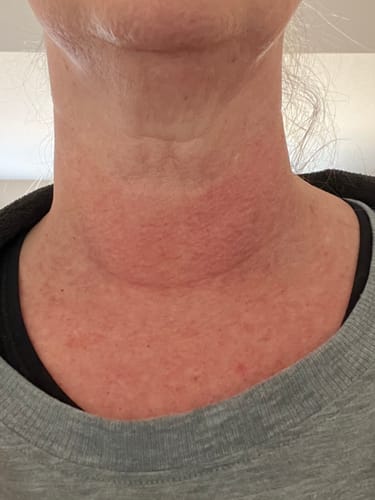 Customer photo review of Besque® Magic Body Oil XL - 200ml