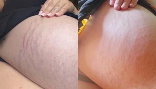 Customer photo review of For Your Buns, Hun