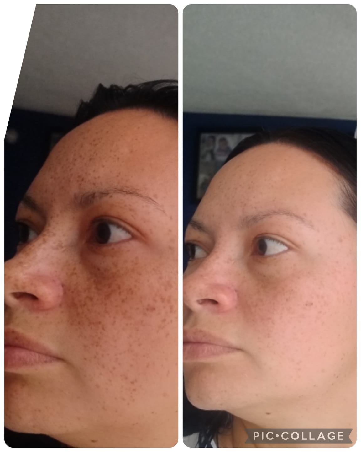 Customer photo review of Tónico Iluminador Aclarante