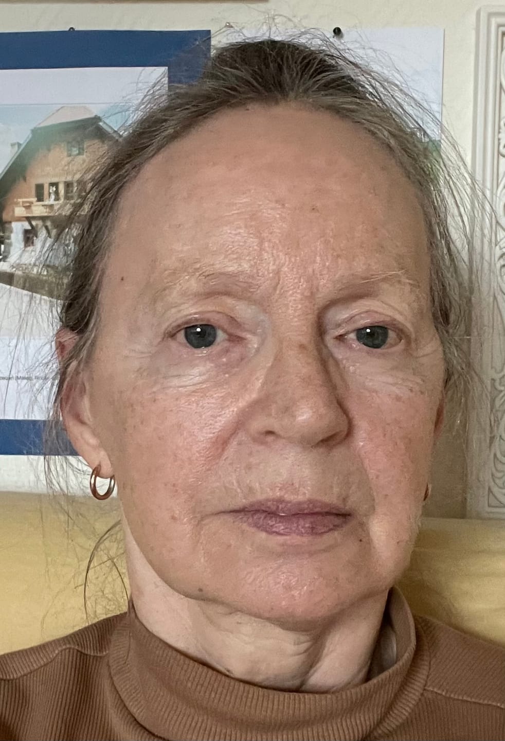 Customer photo review of Réjeunesse Pflegeset