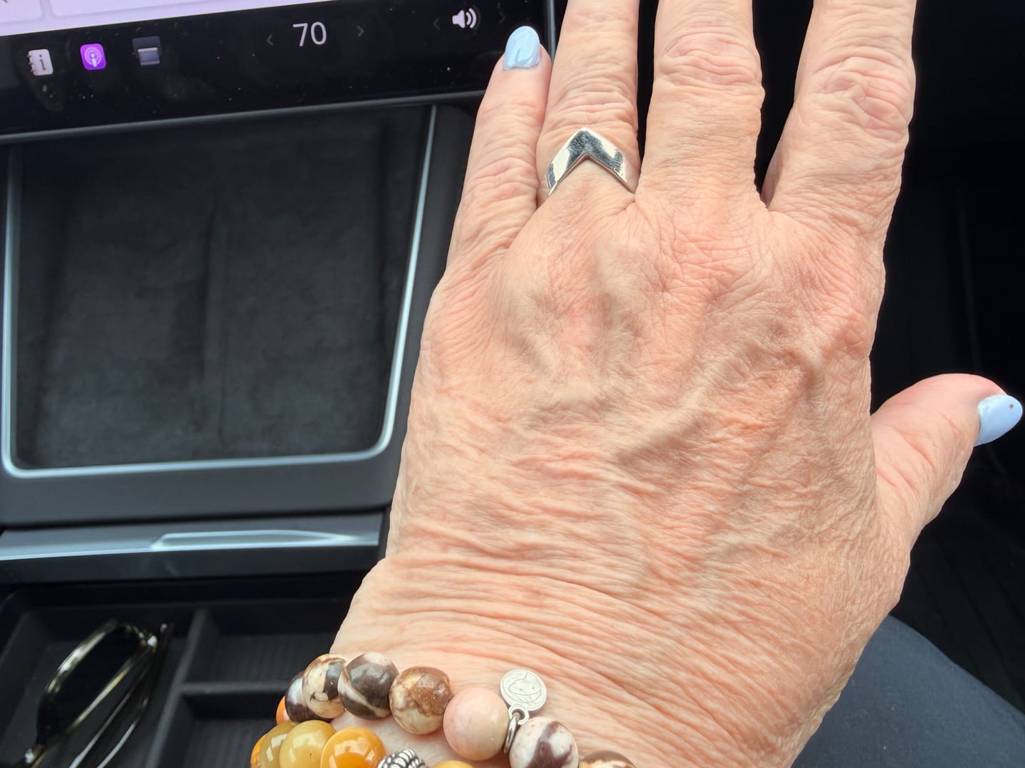 Customer photo review of Zebra Jasper Bracelet
