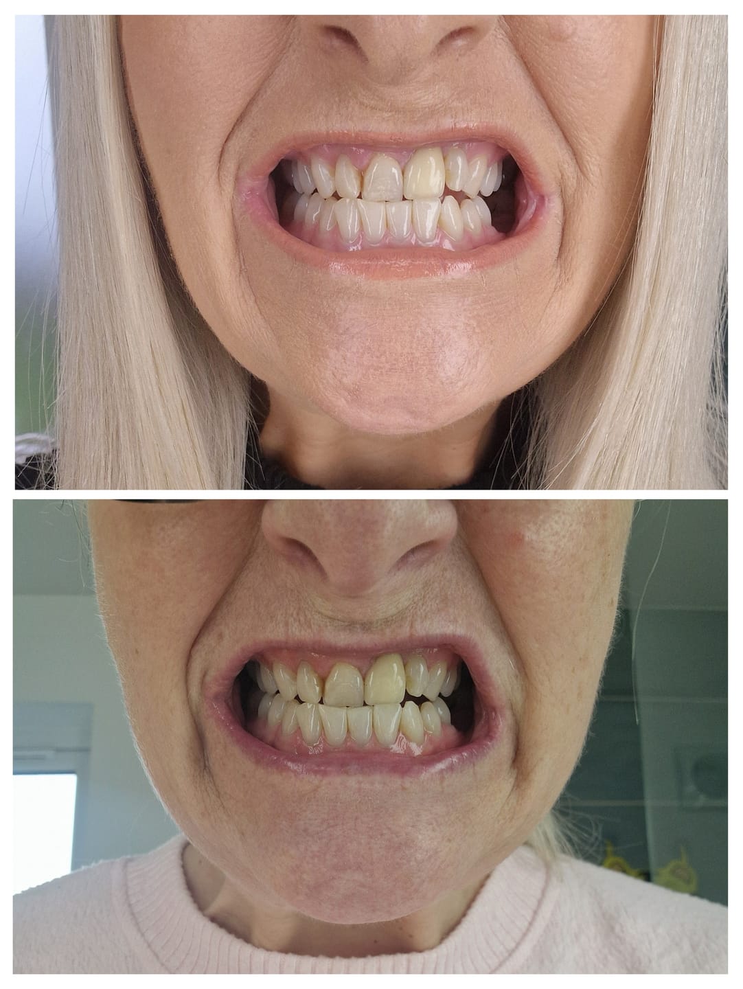 Customer photo review of Mother's Day Oral Care Bundle