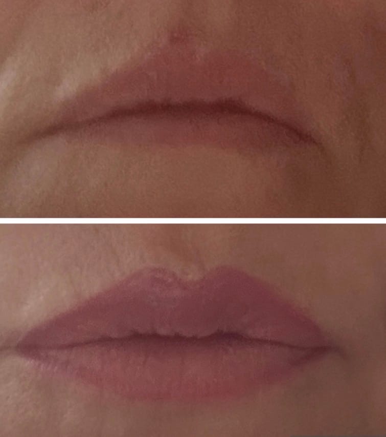 Customer photo review of Triple Lip Plumper Bundle