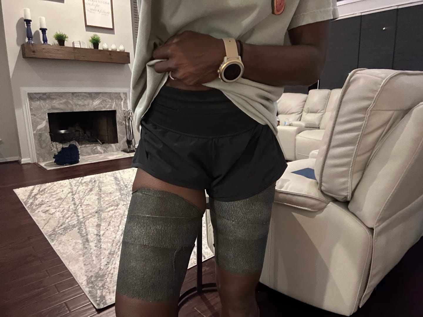 Customer photo review of ICEE TAPE – INSTANT COOLING RECOVERY WRAP