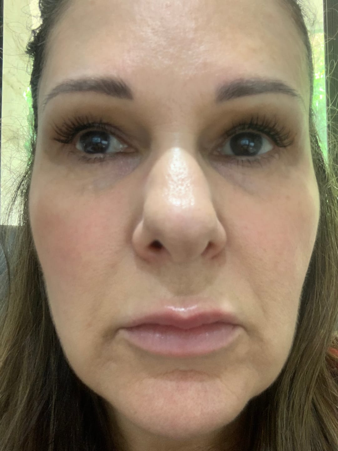 Customer photo review of Purely Lashes Lash Growth Serum