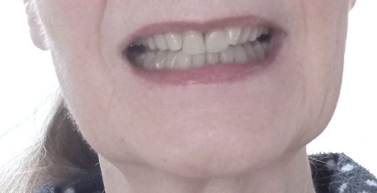 Customer photo review of Loiste GLOW tandkräm