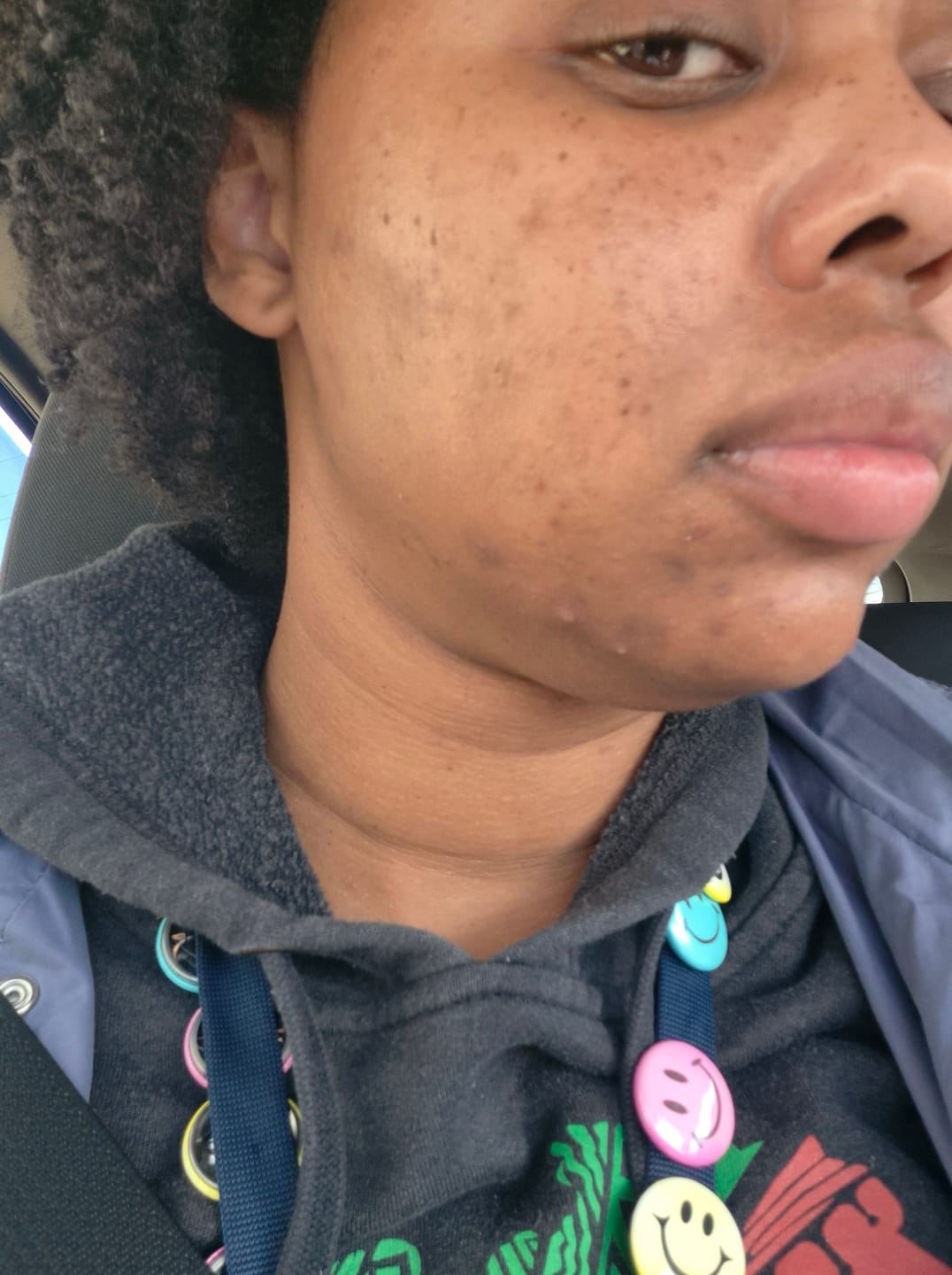 Customer photo review of Melanin Skin Bundle