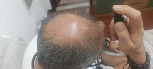 Customer photo review of Kit de crecimiento capilar