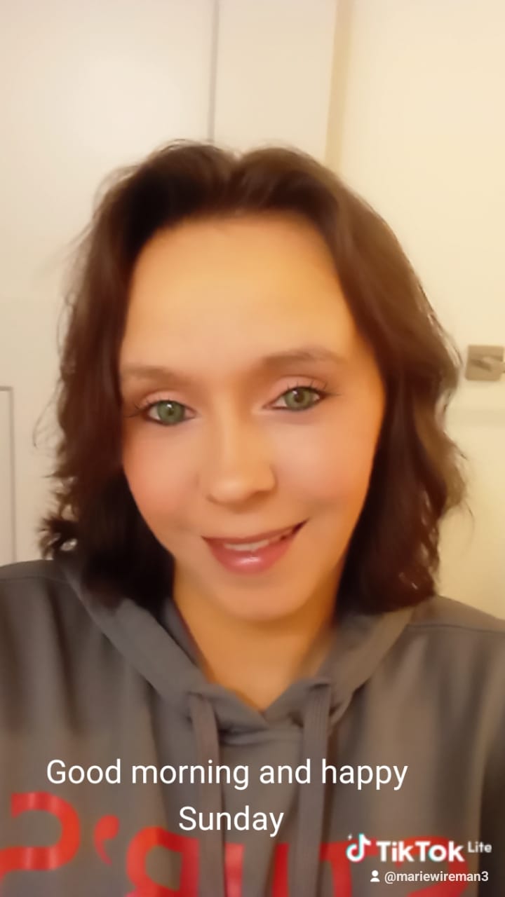 Customer photo review of Himalaya Green Prescription Coloured Contact Lenses