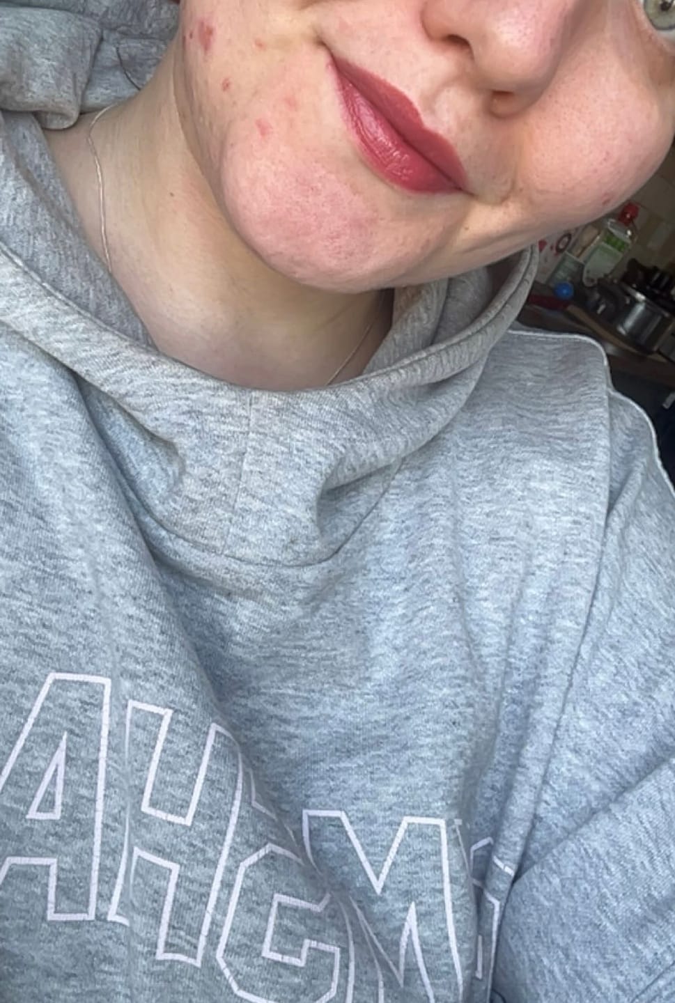 Customer photo review of Glass Kiss Lip Tint