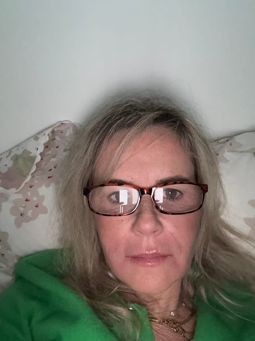 Customer photo review of Glov Micro Infusion System