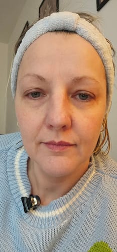 Customer photo review of Masque Collagène Gratuit