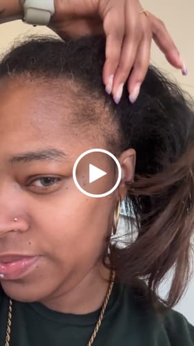 Customer video review of Miracle Hair Growth Oil