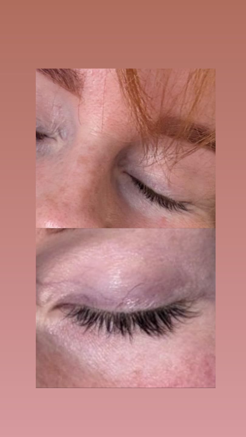 Customer photo review of Wimpernserum