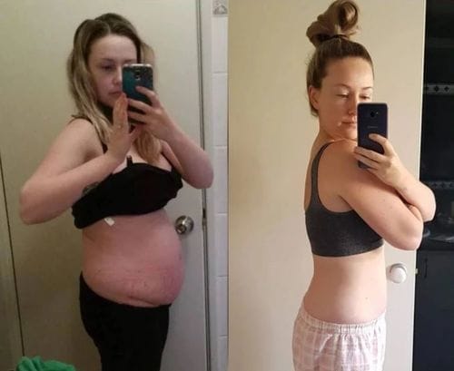 Customer photo review of Complete Postpartum Recovery Bundle