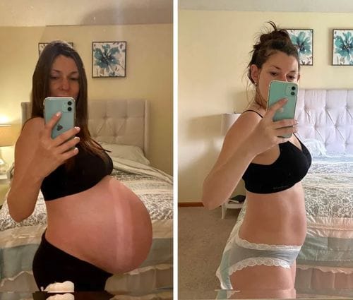 Customer photo review of Complete Postpartum Recovery Bundle