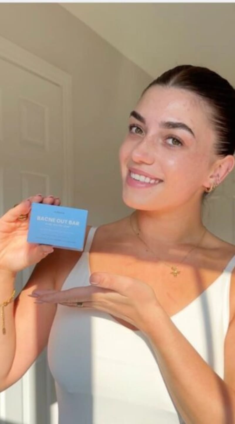 Customer photo review of Barra Anti Acne™