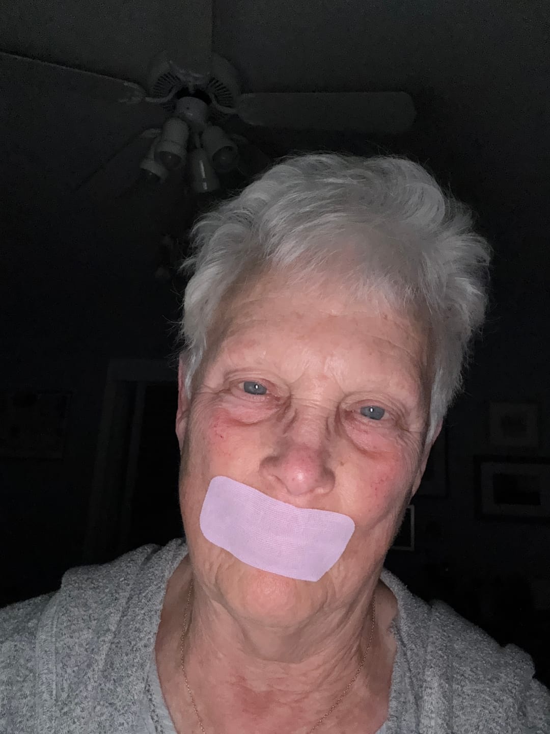 Customer photo review of ZzzTape - Mouth Tape