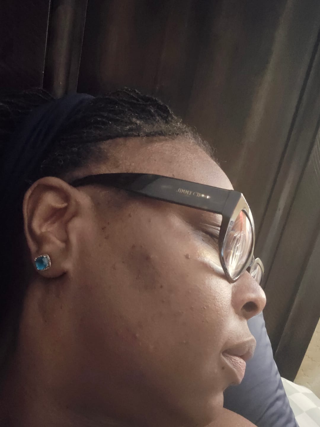 Customer photo review of Melanin Skin Bundle (40% off)