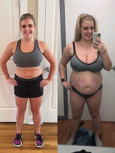 Customer photo review of Complete Postpartum Recovery Bundle
