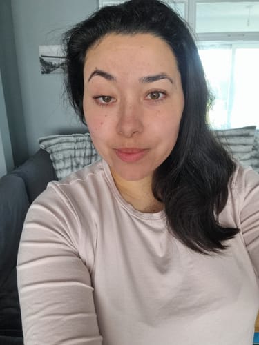 Reviewer's selfie showing their face after one week of using the Koriderm™ Time Reverse Cream.