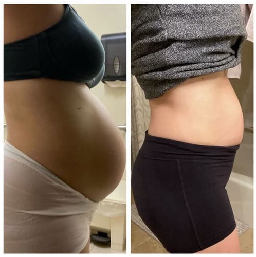 Customer photo review of Complete Postpartum Recovery Bundle