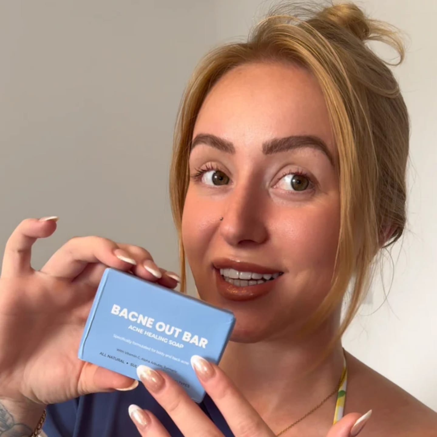 Customer photo review of Barra Anti Acne™