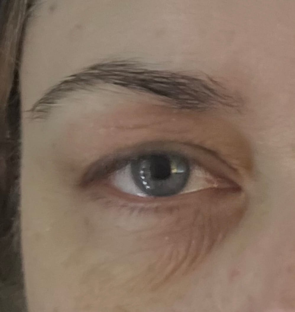Customer photo review of Calm Balm