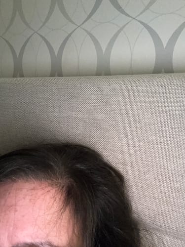 Close-up of a reviewer's dark hair, showing new growth along the hairline after using the shampoo.