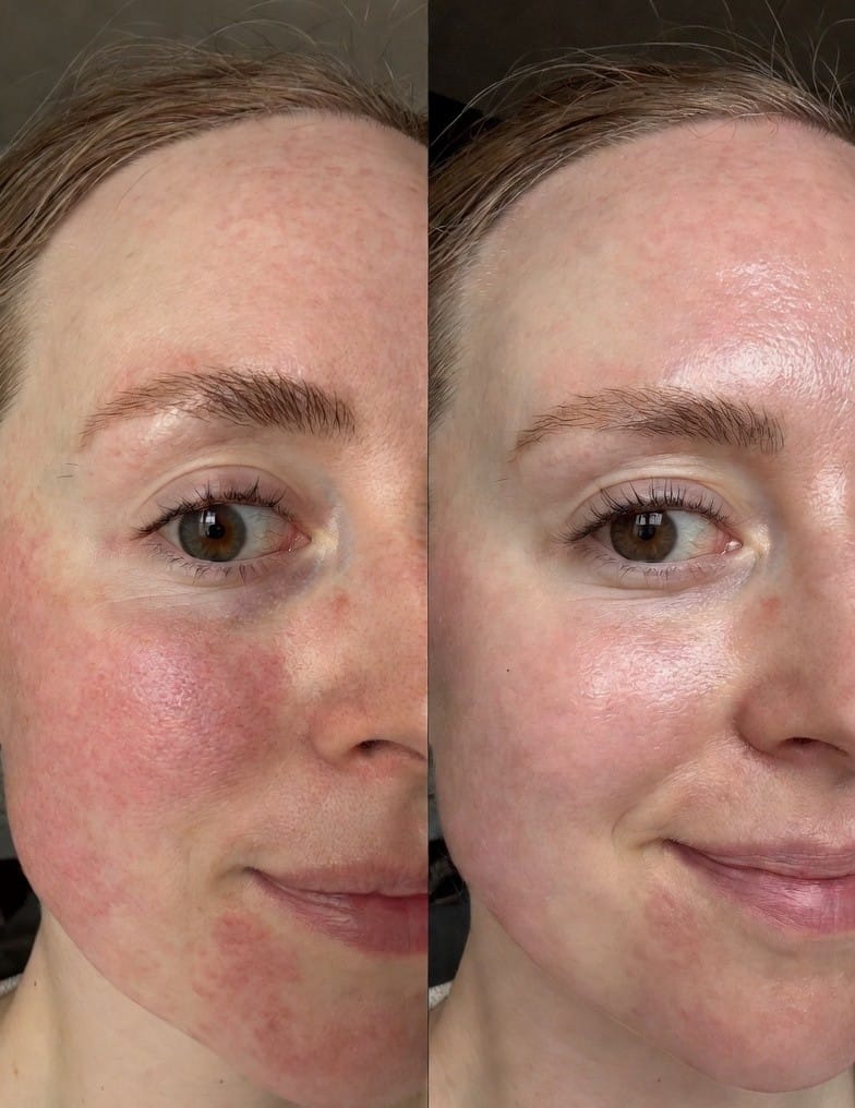 Customer photo review of Silkdrop — The Barrier Serum