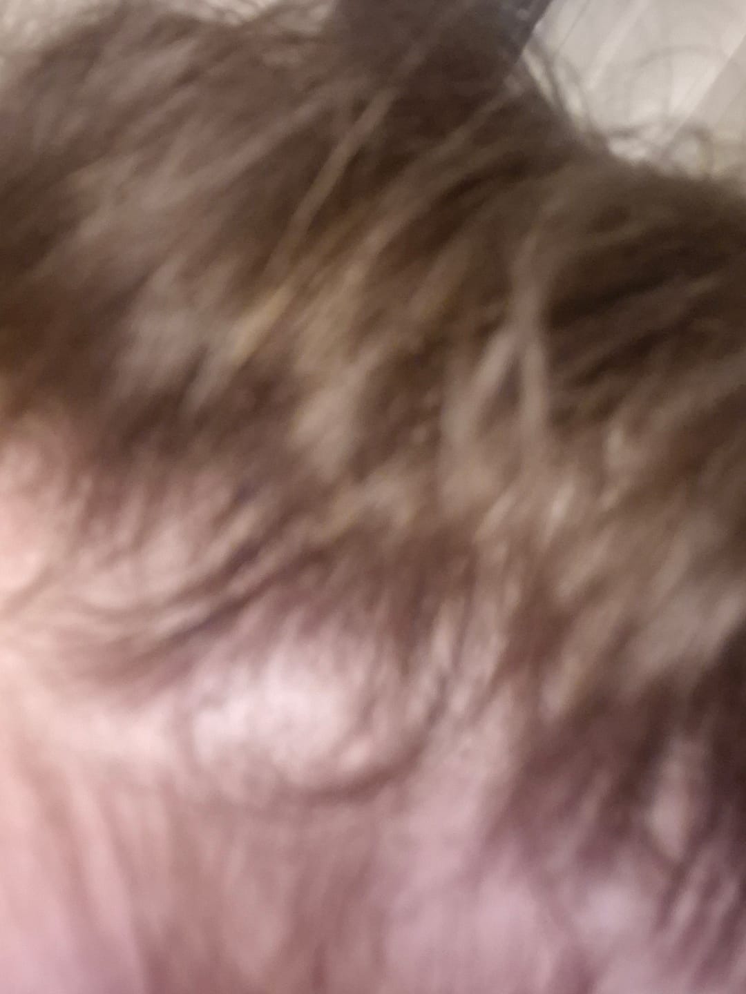 Customer photo review of VITAFOAM ™ Hair Growth Formula