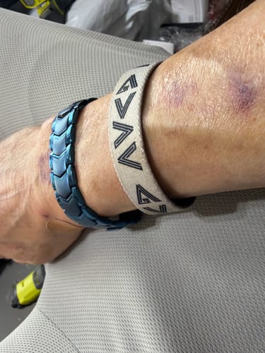 Close-up of a reviewer's wrist wearing the white fabric God Is Greater Bible Verse Bracelet. Some bruising is visible on the arm.