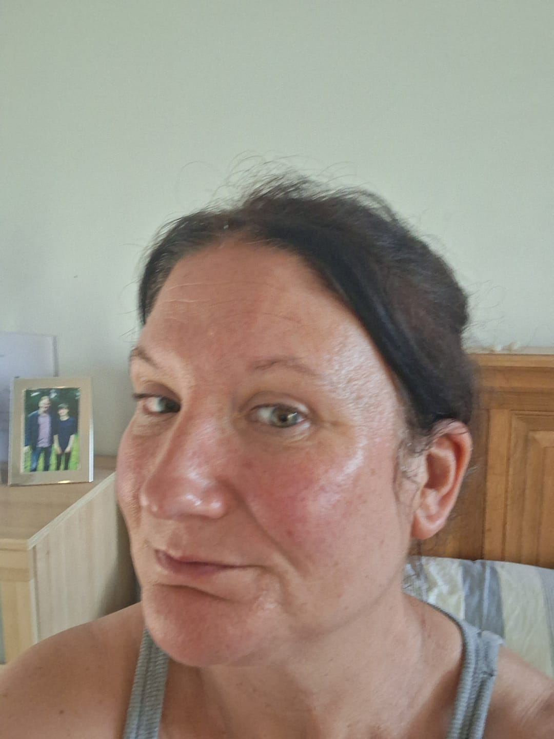 Customer photo review of 5-Step Clear Skin Kit