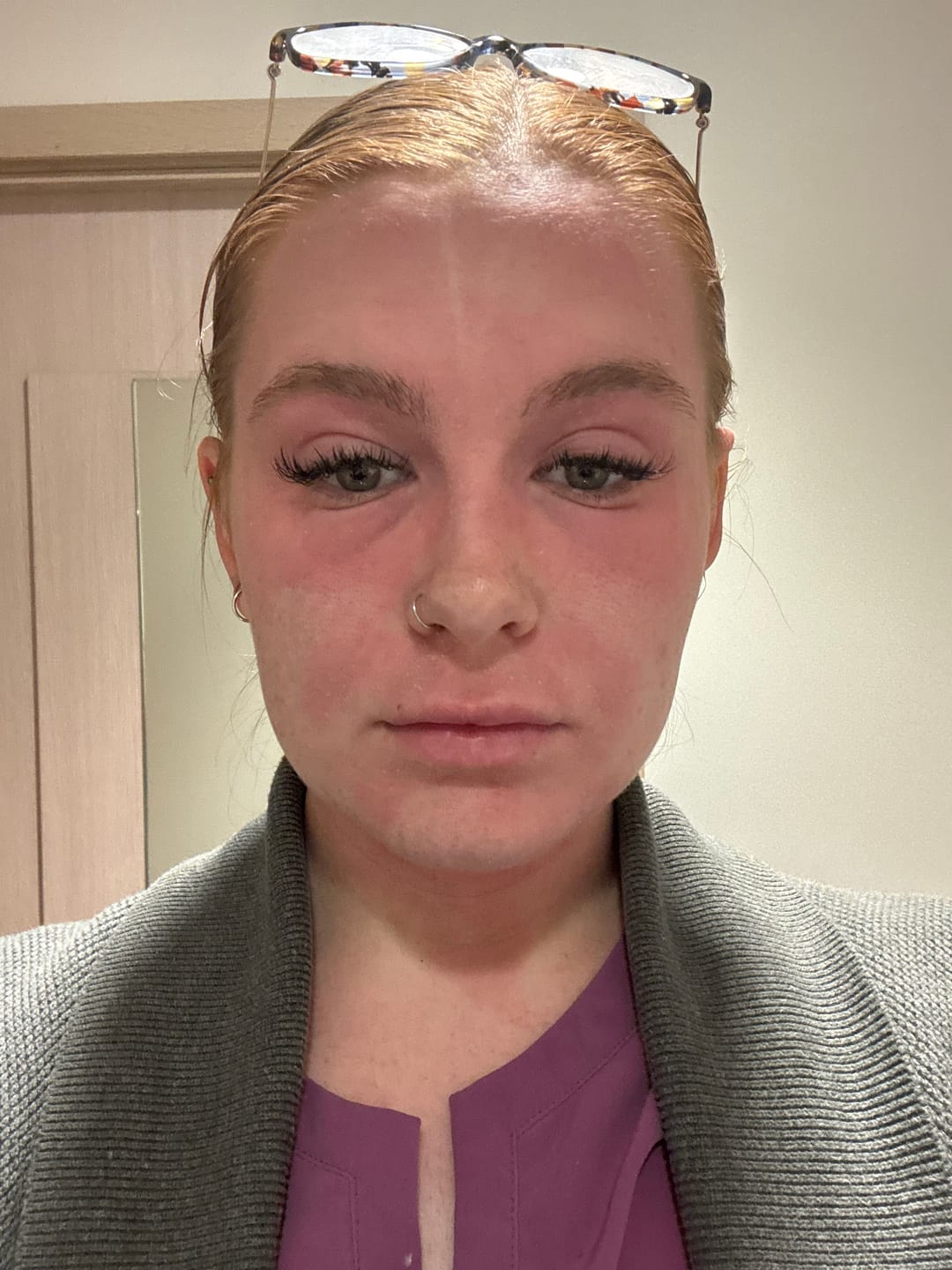 Customer photo review of Cream and Balm Kit | Body, Face & Balm from Grass-Fed Tallow