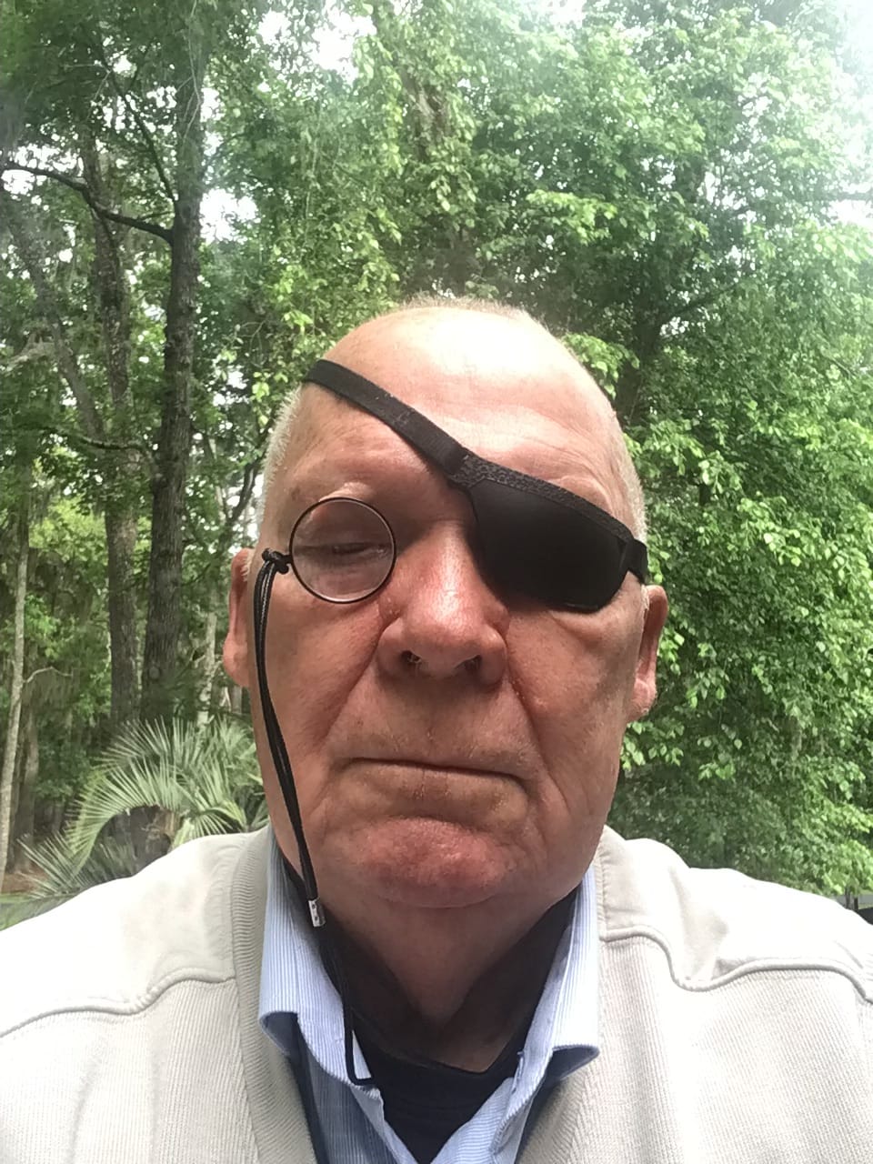 Customer photo review of Monocle - Black
