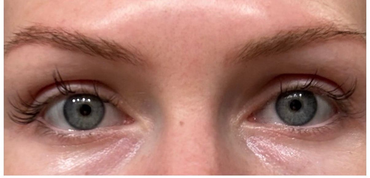 Customer photo review of EYELASH GROWTH SOLUTION