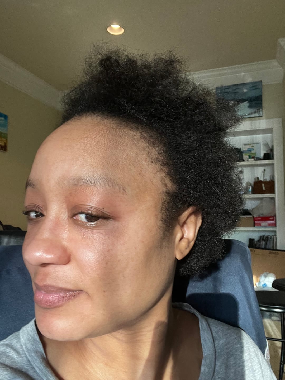 Customer photo review of Scalp Stimulator- 3 Month Supply