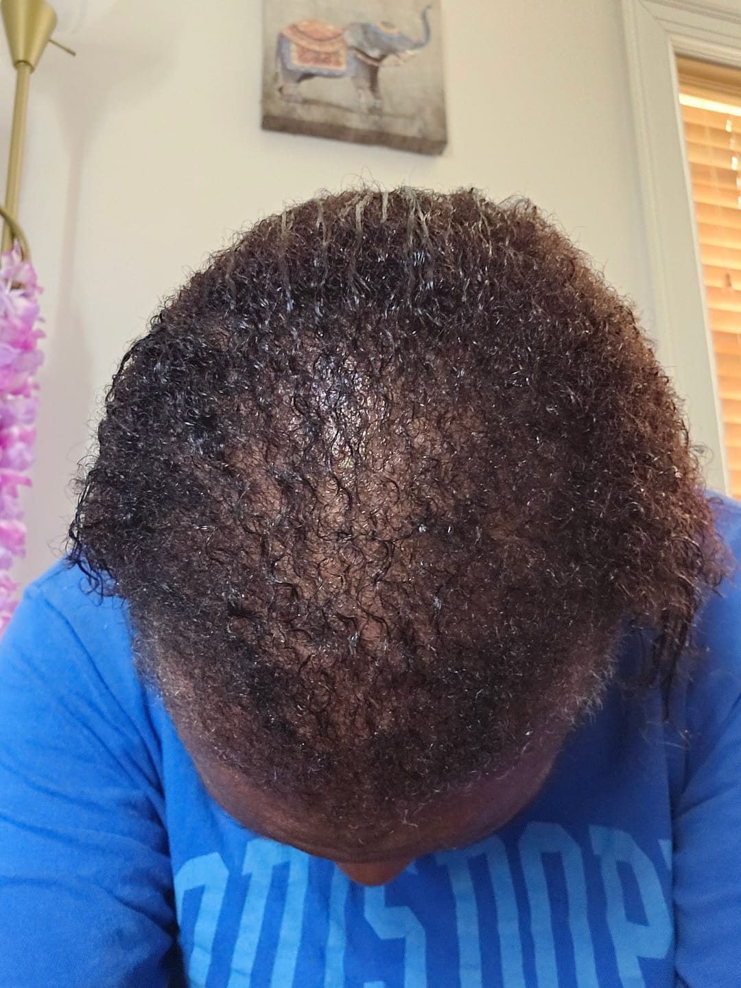 Customer photo review of Moisturize & Seal Bundle